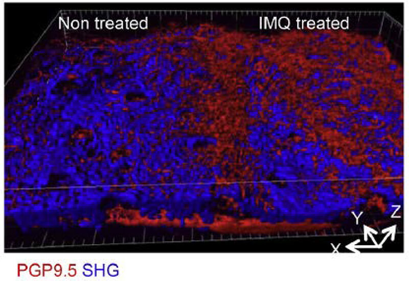図B イミキモド誘発尋常性乾癬様皮膚炎モデル（IMQ）における末梢神経の分布を二光励起顕微鏡で観察